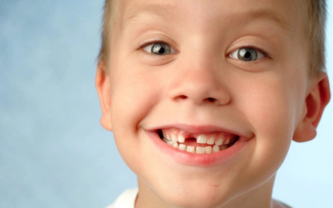 Lose Those Baby Teeth